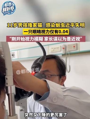 11岁男孩撸猫后视力猛降差点失明，家长误以为是近视，“还好发现得早”！紧急提醒